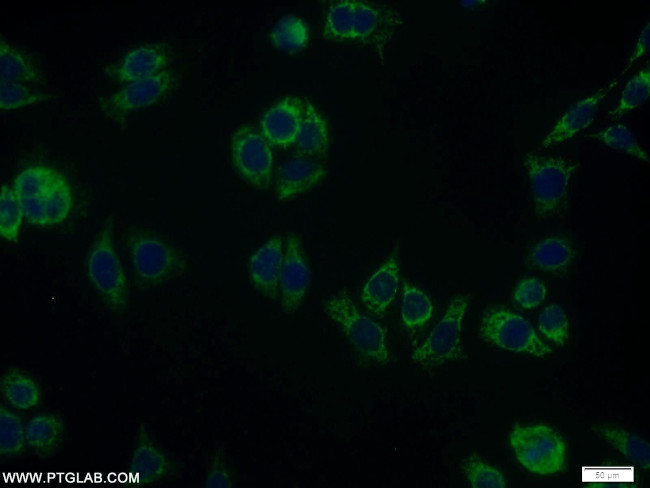 RDH11 Antibody in Immunocytochemistry (ICC/IF)