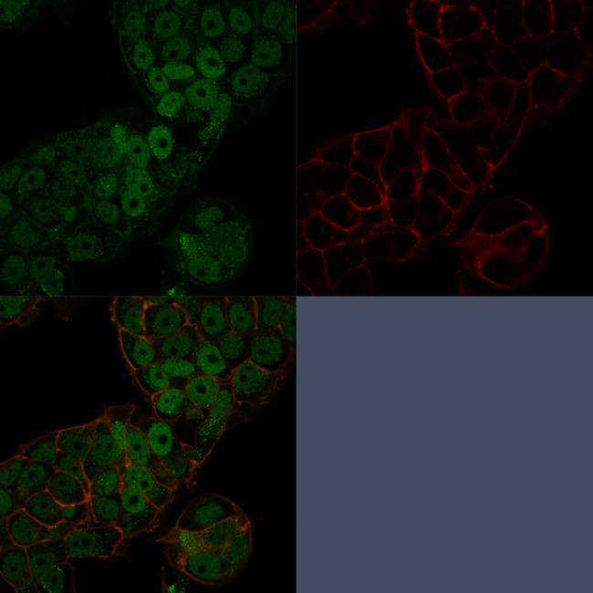 CHD4 Antibody in Immunocytochemistry (ICC/IF)