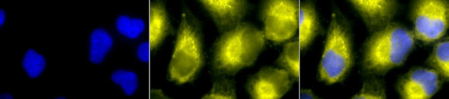 PDI Antibody in Immunocytochemistry (ICC/IF)