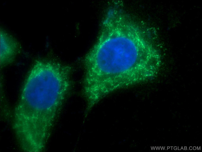SRC Antibody in Immunocytochemistry (ICC/IF)