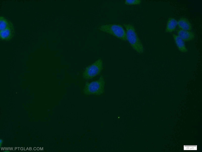 STK38 Antibody in Immunocytochemistry (ICC/IF)