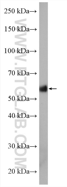 ACVR1 Antibody in Western Blot (WB)