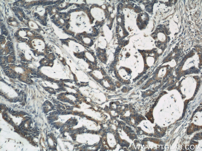 CYLD Antibody in Immunohistochemistry (Paraffin) (IHC (P))