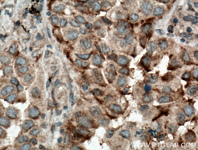 ARHGEF10 Antibody in Immunohistochemistry (Paraffin) (IHC (P))