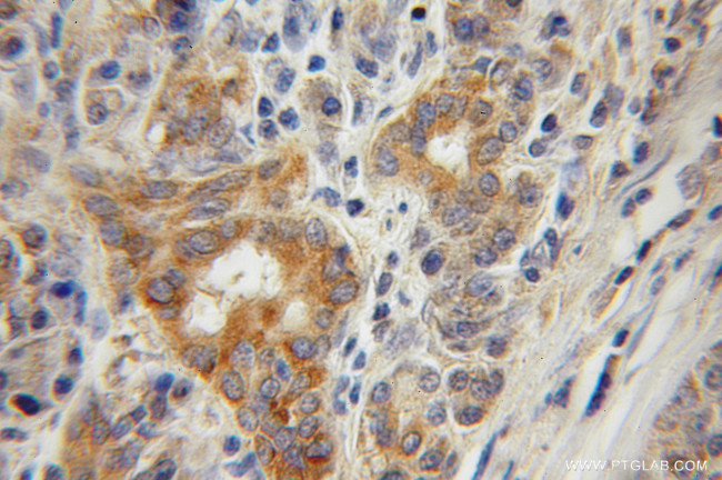 CTDSP2 Antibody in Immunohistochemistry (Paraffin) (IHC (P))
