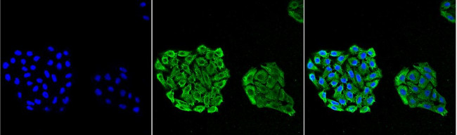 Hsp70 Antibody in Immunocytochemistry (ICC/IF)