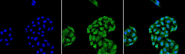Hsp70 Antibody in Immunocytochemistry (ICC/IF)