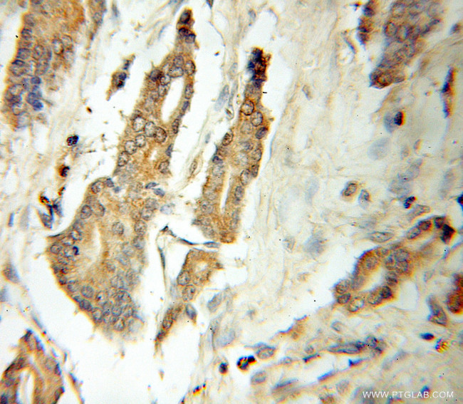 ATG12 Antibody in Immunohistochemistry (Paraffin) (IHC (P))