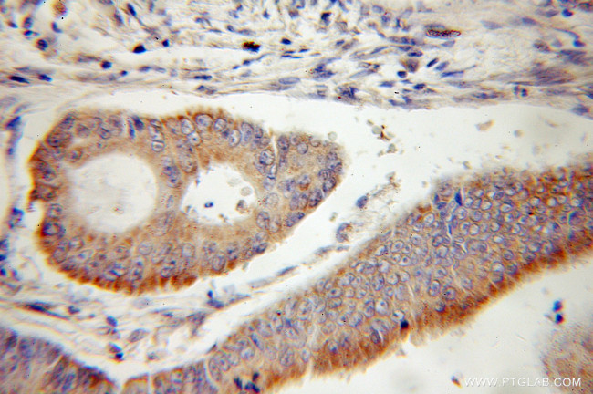 TIMM10 Antibody in Immunohistochemistry (Paraffin) (IHC (P))