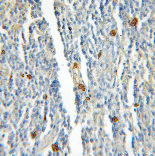 Rad51D Antibody in Immunohistochemistry (Paraffin) (IHC (P))