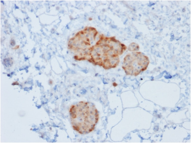 Chromogranin A/CHGA (Neuroendocrine Marker) Antibody in Immunohistochemistry (Paraffin) (IHC (P))
