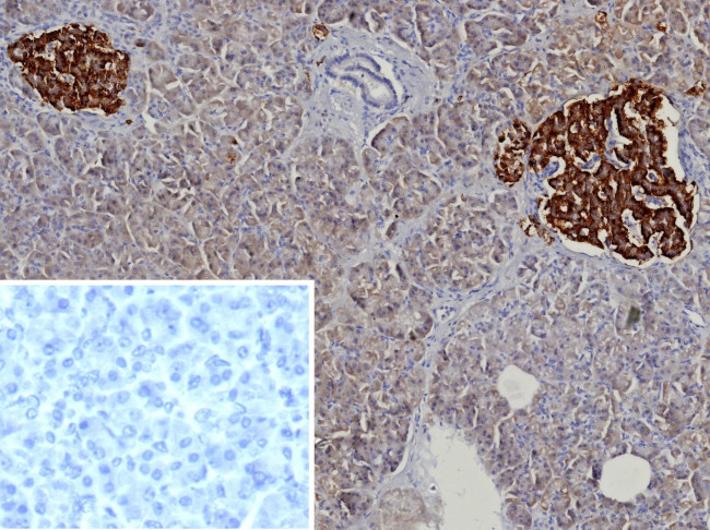 Chromogranin A/CHGA (Neuroendocrine Marker) Antibody in Immunohistochemistry (Paraffin) (IHC (P))