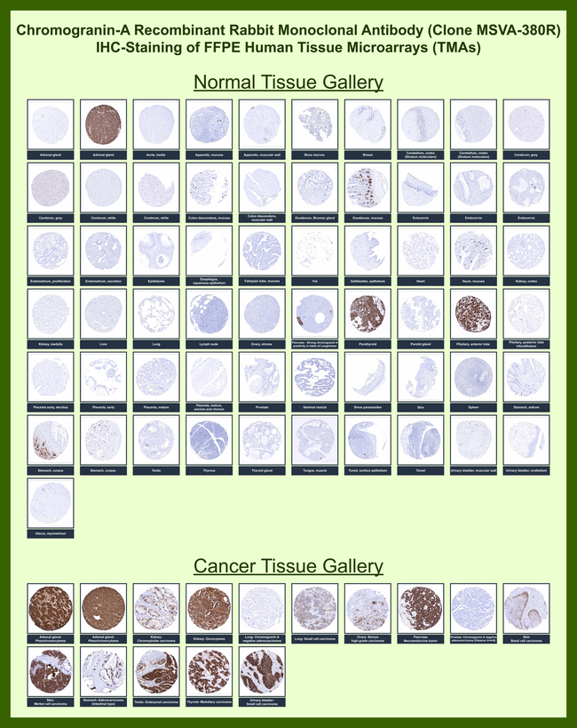 Chromogranin A/CHGA (Neuroendocrine Marker) Antibody in Immunohistochemistry (Paraffin) (IHC (P))