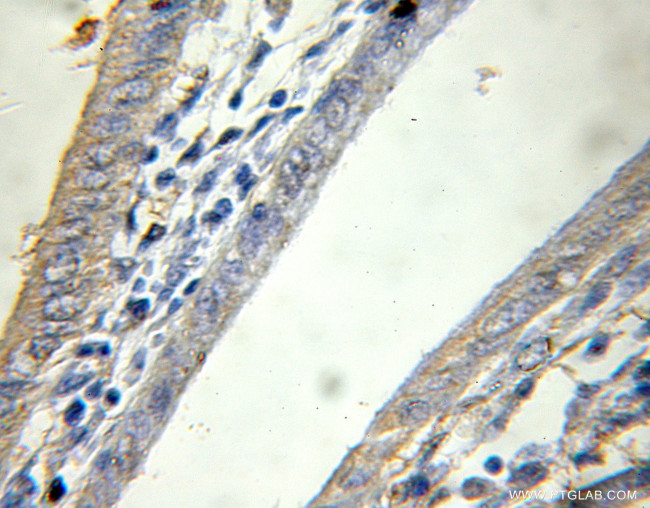 PTPN4 Antibody in Immunohistochemistry (Paraffin) (IHC (P))