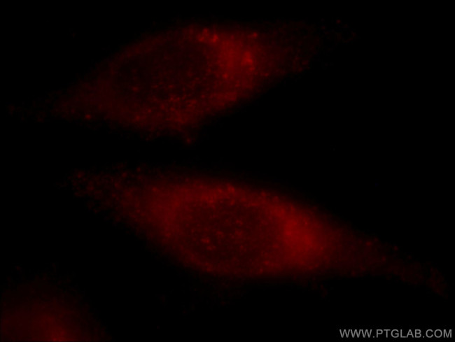 CNOT3 Antibody in Immunocytochemistry (ICC/IF)