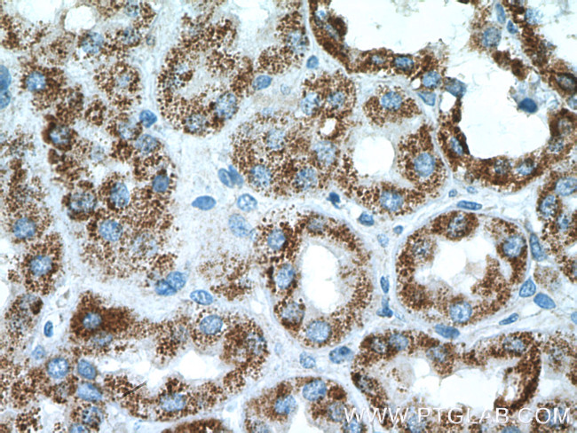 PCCB Antibody in Immunohistochemistry (Paraffin) (IHC (P))