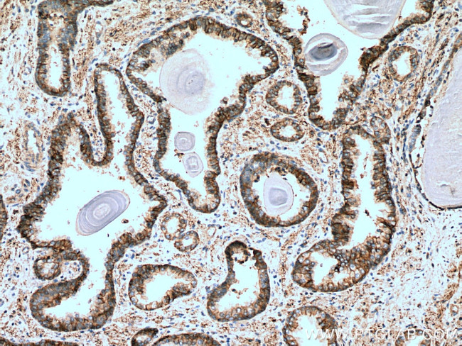 ATP1B3 Antibody in Immunohistochemistry (Paraffin) (IHC (P))