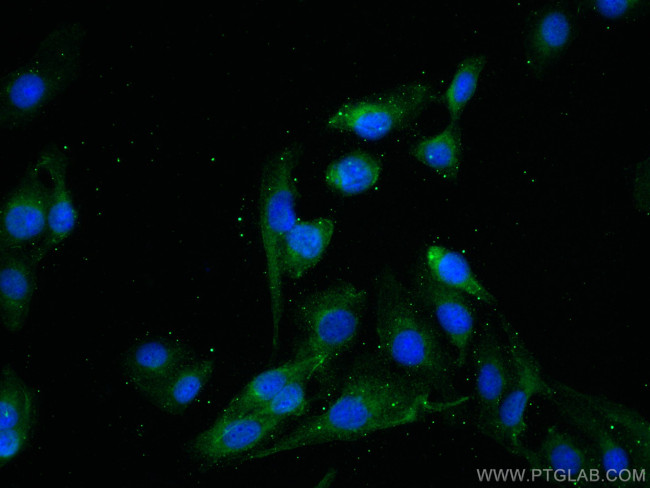 HOMER2 Antibody in Immunocytochemistry (ICC/IF)
