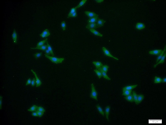 P2RX7 Antibody in Immunocytochemistry (ICC/IF)