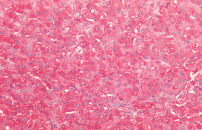 Hsp60 Antibody in Immunohistochemistry (Paraffin) (IHC (P))