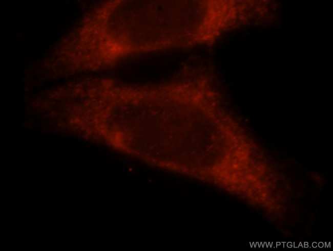 CBP/EIF4E Antibody in Immunocytochemistry (ICC/IF)