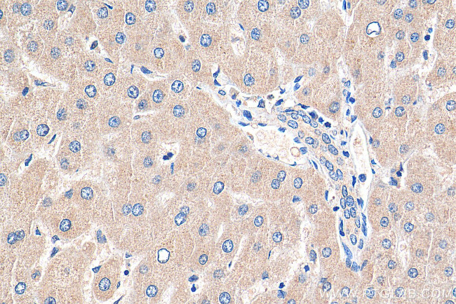 MYEOV Antibody in Immunohistochemistry (Paraffin) (IHC (P))