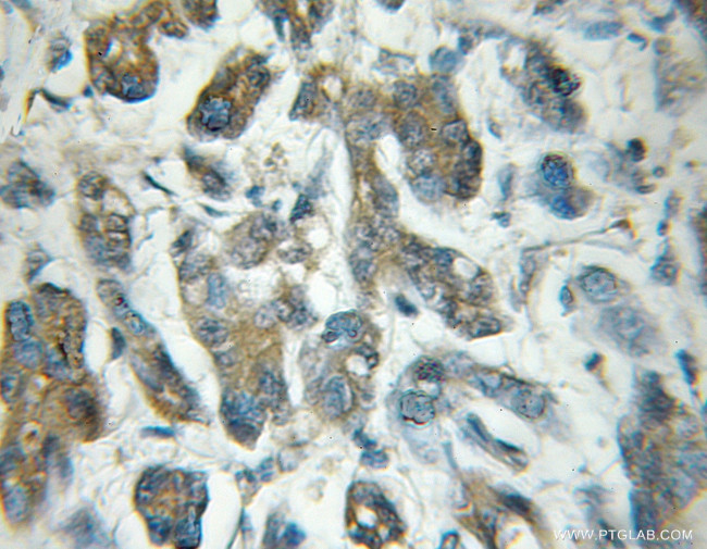 EIF5 Antibody in Immunohistochemistry (Paraffin) (IHC (P))