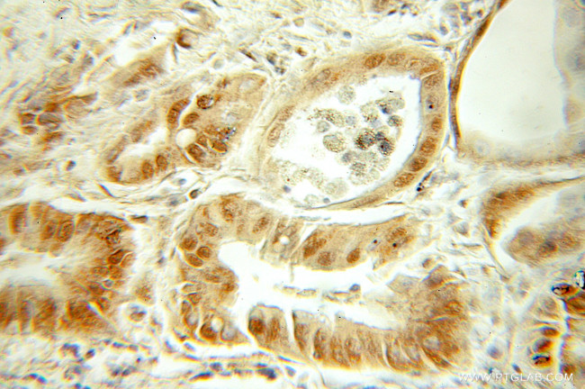 SMARCD2 Antibody in Immunohistochemistry (Paraffin) (IHC (P))