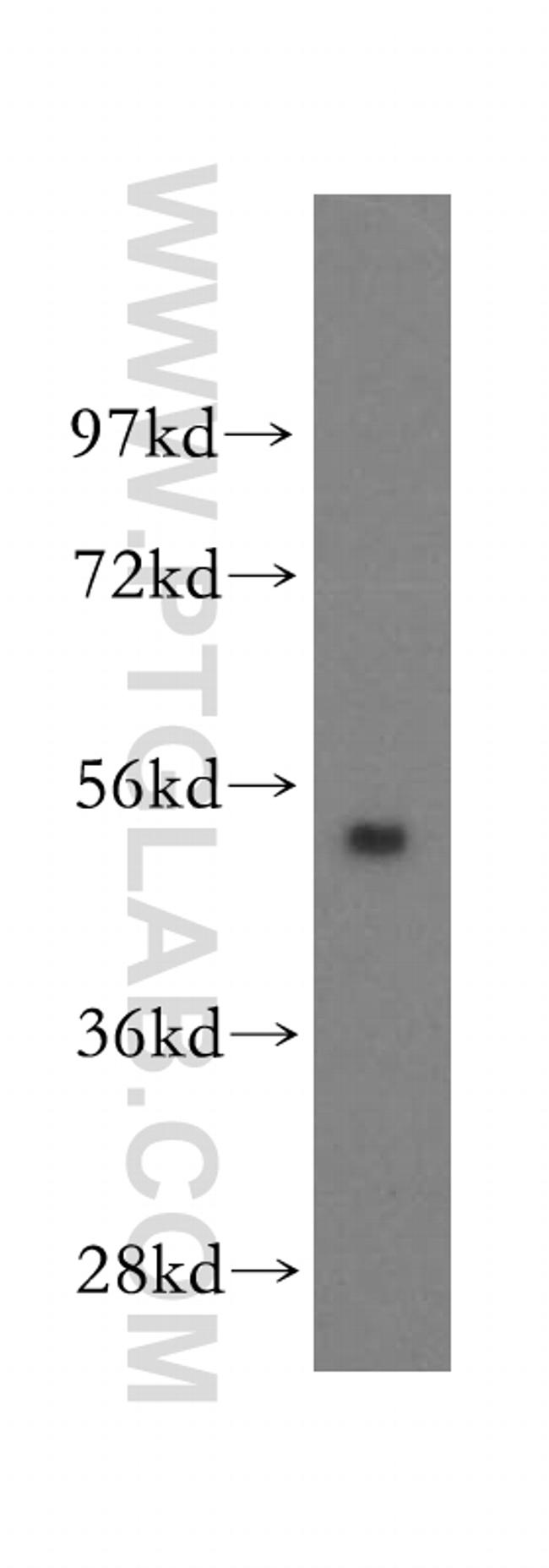 FBXO9 Antibody in Western Blot (WB)