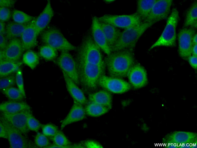 EIF2S3 Antibody in Immunocytochemistry (ICC/IF)