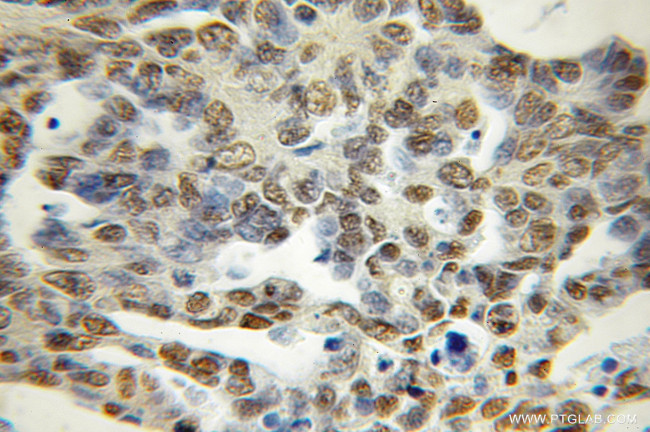 PCTP Antibody in Immunohistochemistry (Paraffin) (IHC (P))