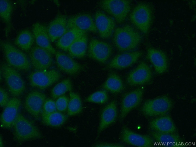ARHGAP1 Antibody in Immunocytochemistry (ICC/IF)