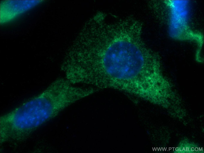 EXOSC10 Antibody in Immunocytochemistry (ICC/IF)