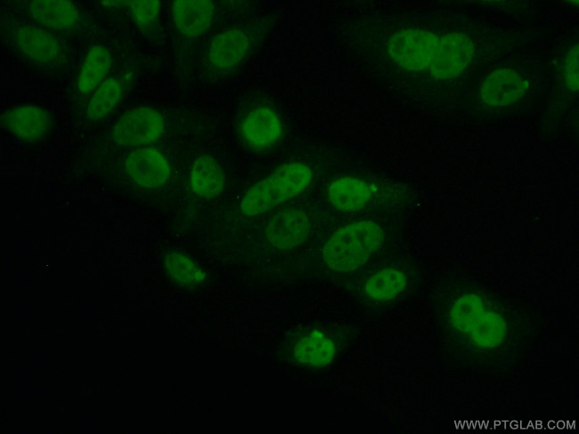 PCNP Antibody in Immunocytochemistry (ICC/IF)