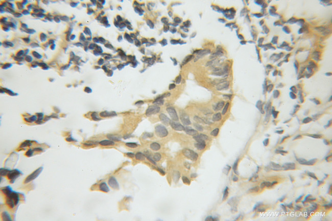 CPNE3 Antibody in Immunohistochemistry (Paraffin) (IHC (P))