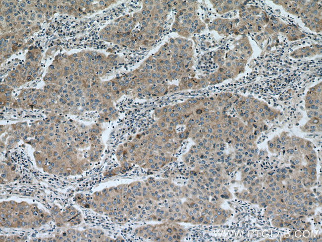 TIMM17A Antibody in Immunohistochemistry (Paraffin) (IHC (P))