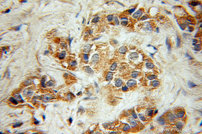 Actopaxin Antibody in Immunohistochemistry (Paraffin) (IHC (P))