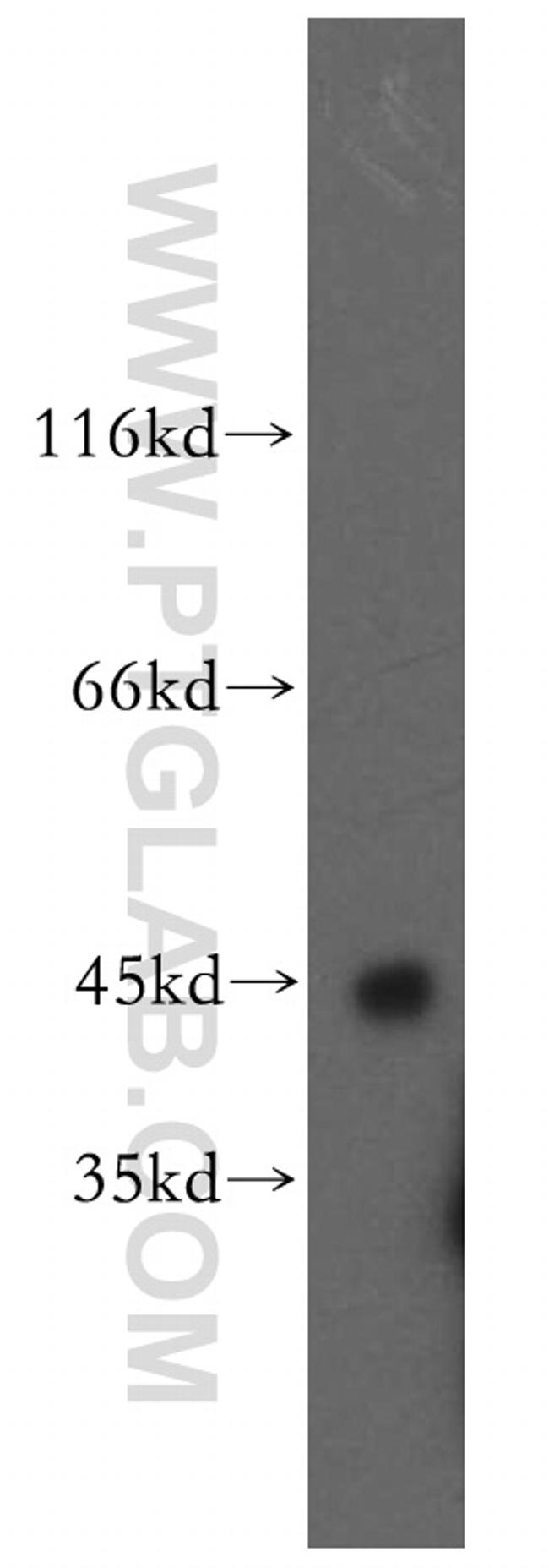 SPAM1 Antibody in Western Blot (WB)