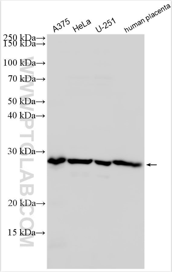 CCNL2 Antibody in Western Blot (WB)