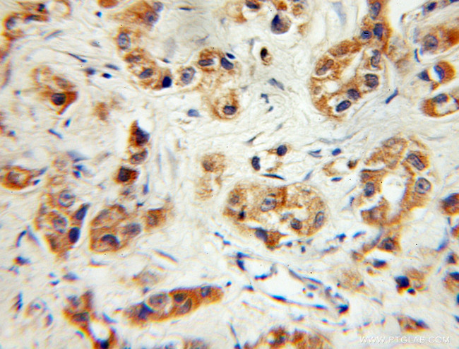 PVRL3/Nectin 3 Antibody in Immunohistochemistry (Paraffin) (IHC (P))