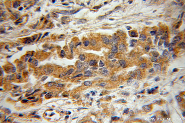 BIN3 Antibody in Immunohistochemistry (Paraffin) (IHC (P))