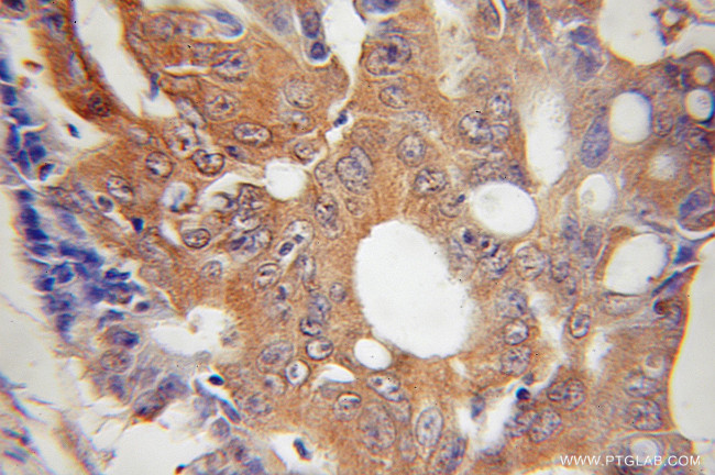 HUS1 Antibody in Immunohistochemistry (Paraffin) (IHC (P))