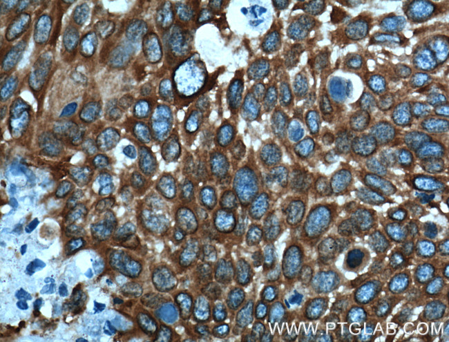 MAP4 Antibody in Immunohistochemistry (Paraffin) (IHC (P))