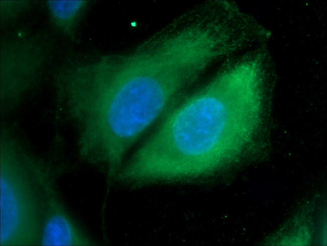 Cathepsin K Antibody in Immunocytochemistry (ICC/IF)