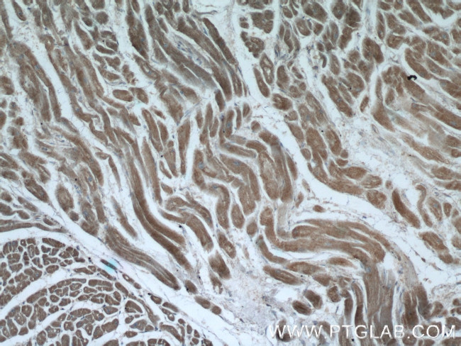 EDEM2 Antibody in Immunohistochemistry (Paraffin) (IHC (P))