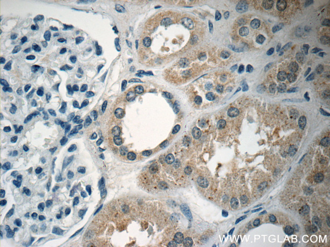 ARHGEF18 Antibody in Immunohistochemistry (Paraffin) (IHC (P))