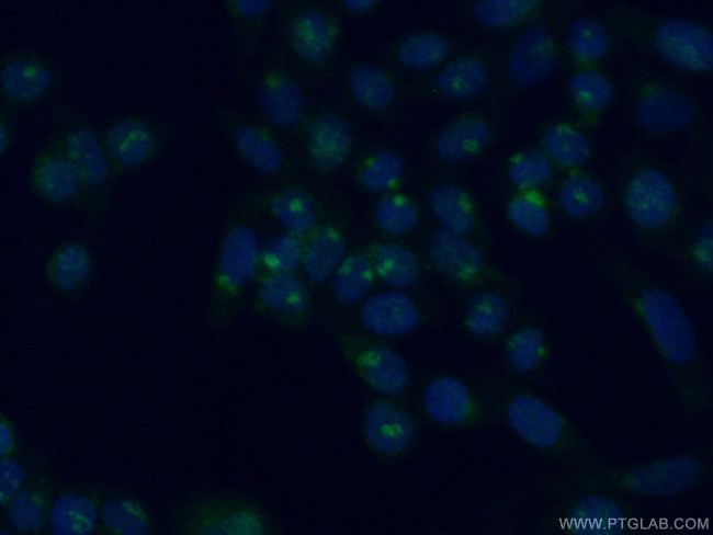 SCYL3 Antibody in Immunocytochemistry (ICC/IF)