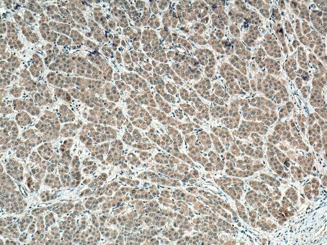PMM1 Antibody in Immunohistochemistry (Paraffin) (IHC (P))