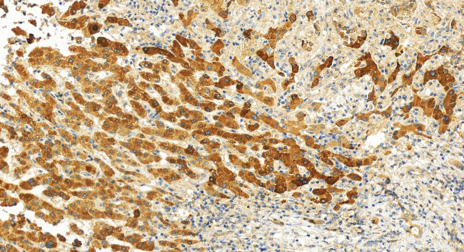 SH3BGRL Antibody in Immunohistochemistry (Paraffin) (IHC (P))