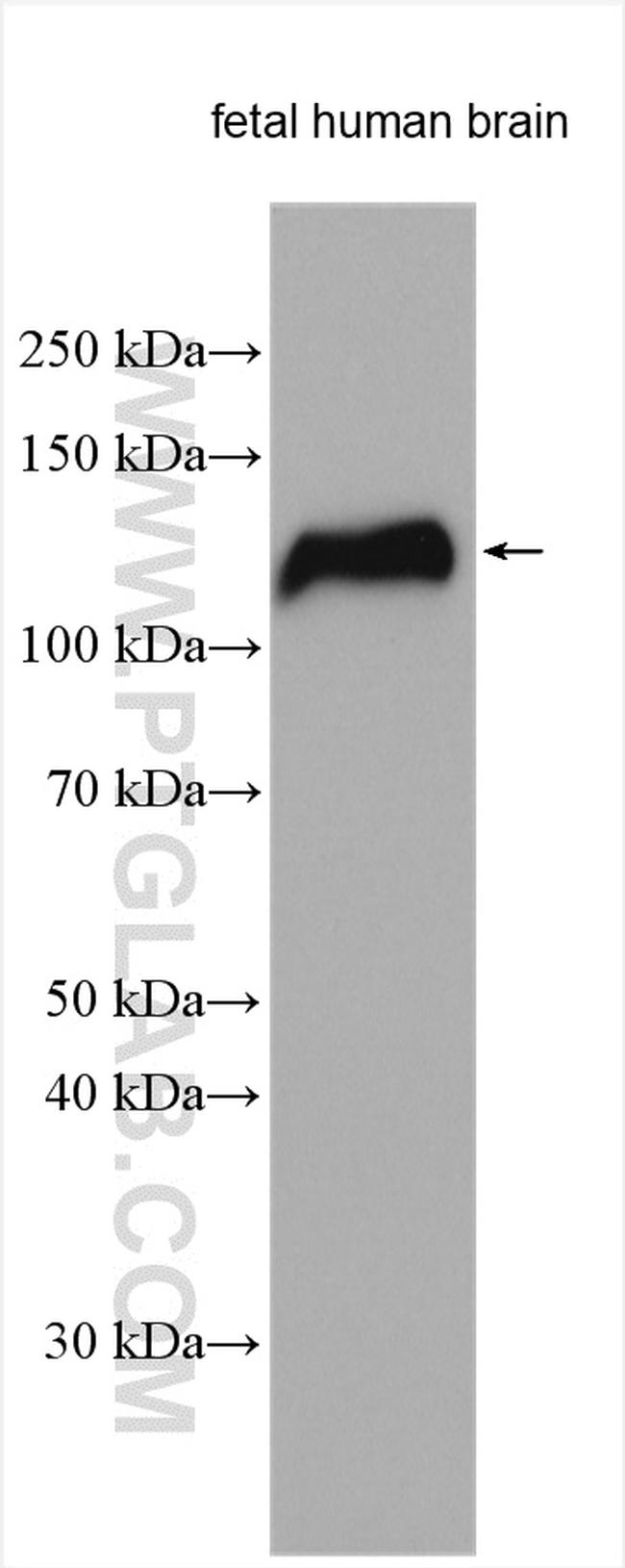 NELL2 Antibody in Western Blot (WB)